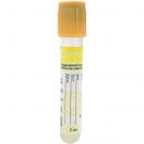 Пробірка вакуумна EximLab 5 мл з активатором згортання та розділовим гелем жовта кришка 13х100 мм foto 1