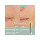 Засіб Caudalie (Кодалі) Vinopure SOS із саліциловою кислотою, 15 мл foto 2