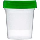 Контейнер для забору сечі 60 мл, стерильний, 1 шт. foto 1