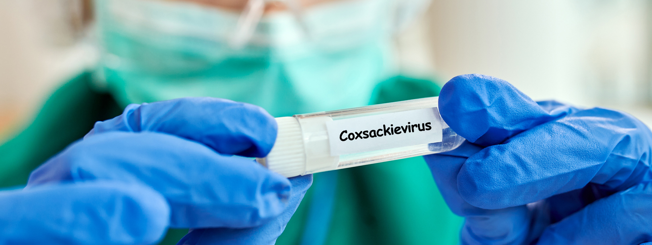 Вірус Коксакі